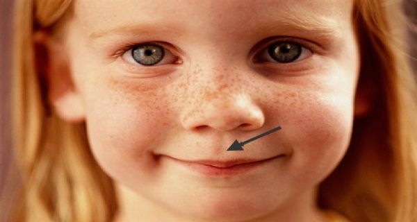 почему у нас желобок под носом