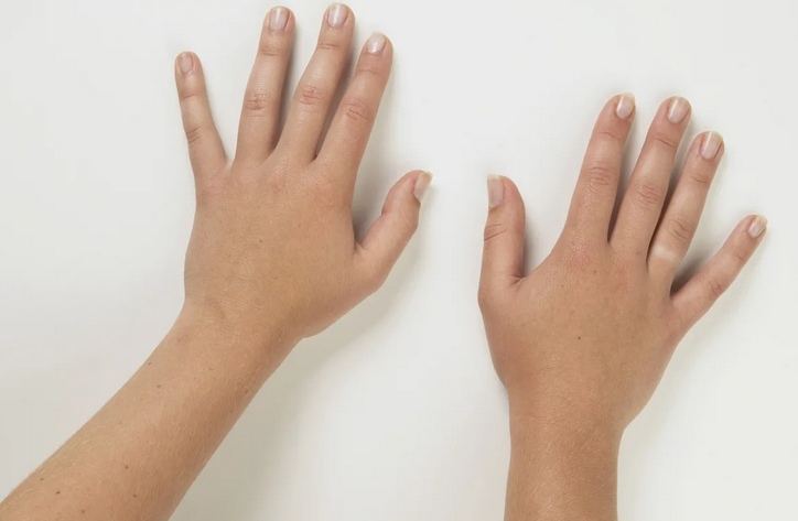 Короткие пальцы