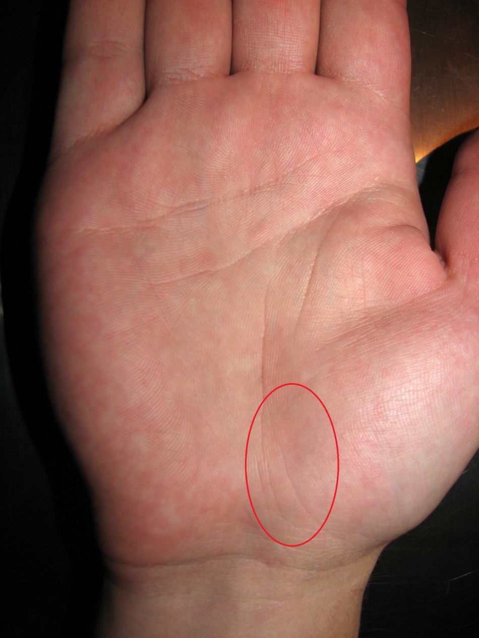 Развилка на линии судьбы в начале или конце - свобода выбора