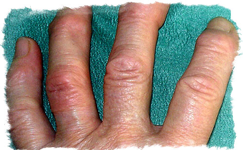 толстые пальцы