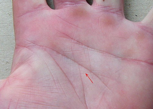 Знаки удачи и богатства, хиромантия: пример «треугольник в треугольнике» Знаки удачи и богатства, хиромантия: пример «треугольник в треугольнике»