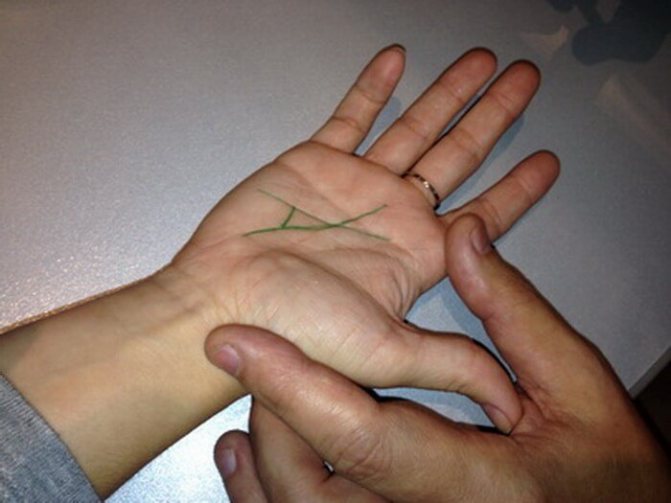 Большой треугольник на правой ладони