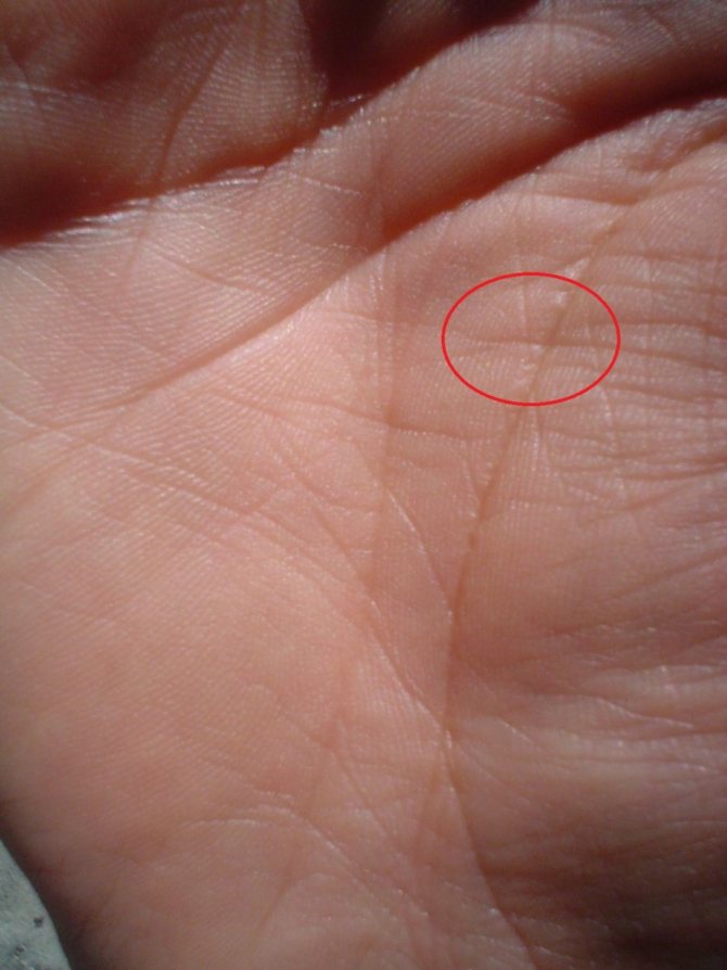 Крест на линии жизни ничего опасного не предсказывает