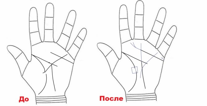 Квадрат на линии жизни может появиться со временем на изломе, символизируя успешное решение проблем