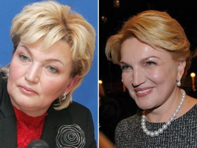 Топ-12 знаменитостей, которые сделали пластические операции лучше, чем Анна Герман — фото 7