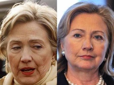 Топ-12 знаменитостей, которые сделали пластические операции лучше, чем Анна Герман — фото 9