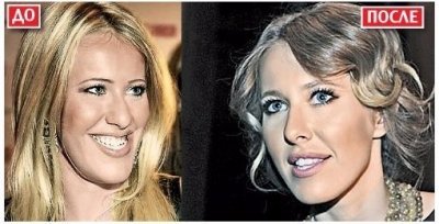 Топ-12 знаменитостей, которые сделали пластические операции лучше, чем Анна Герман — фото 11