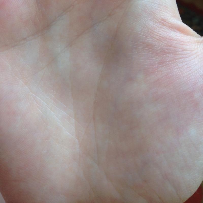 Треугольник на линии жизни – знак дипломата и мецената